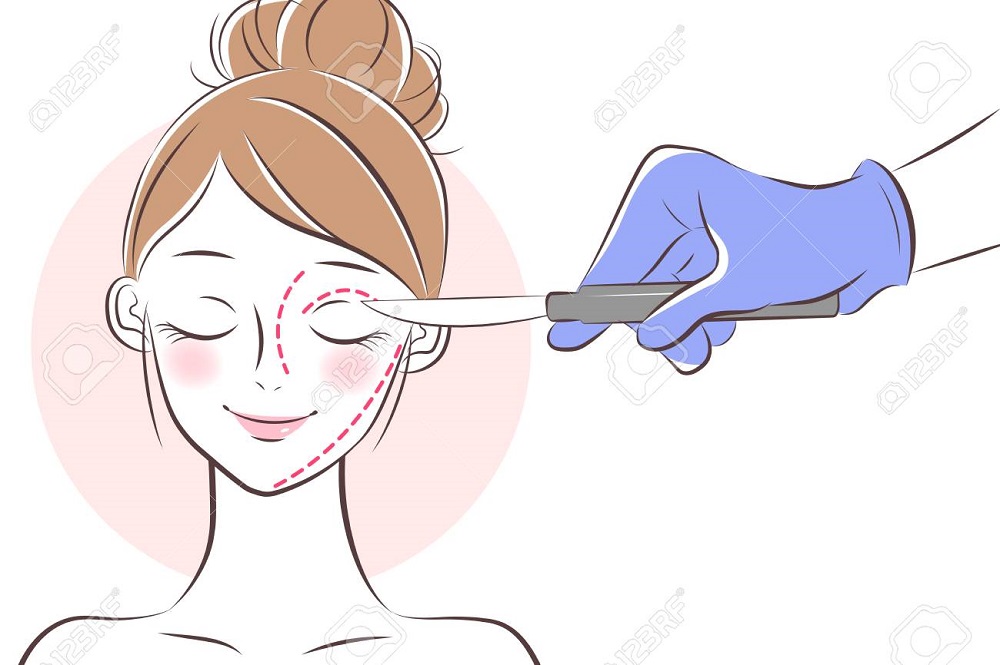 Face Lift Can U Still Hear Me